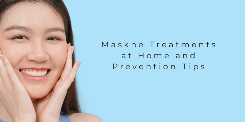 Maskne-Treatment-at-Home-and-Prevention-Tips-banner-06